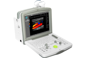 Ecógrafos Doppler Color