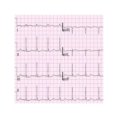 ECG Rollos Térmicos